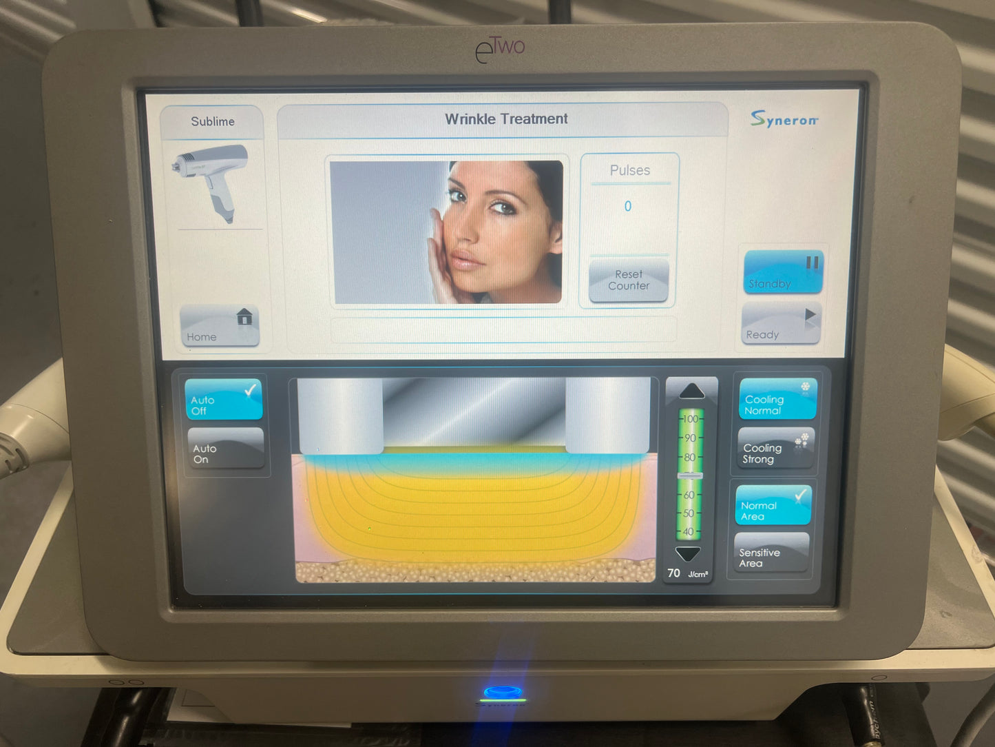 Syneron etwo Machine